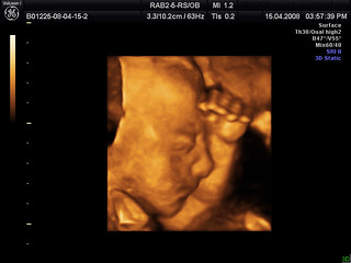 Baby Bob in 3D - We went for our 4D ultrasound yesterday and… - Flickr