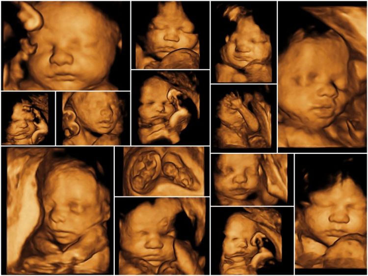 3D/4D Ultrasound - Southern OB/GYN Associates