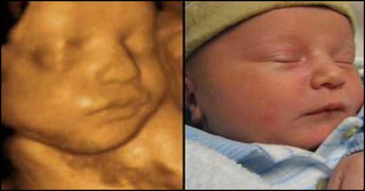 What is A 4D Ultrasound Scan & How It Works?