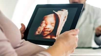 3D Ultrasound & 4D Ultrasounds During Pregnancy: Are 3D and 4D Sonograms Safe?