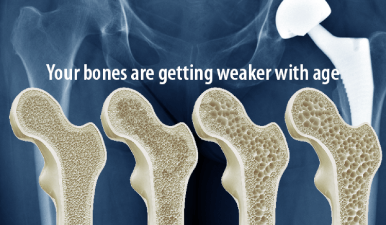 bone densitometry